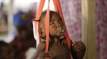 UNICEF alerta del riesgo de hambruna para un millón de niños
